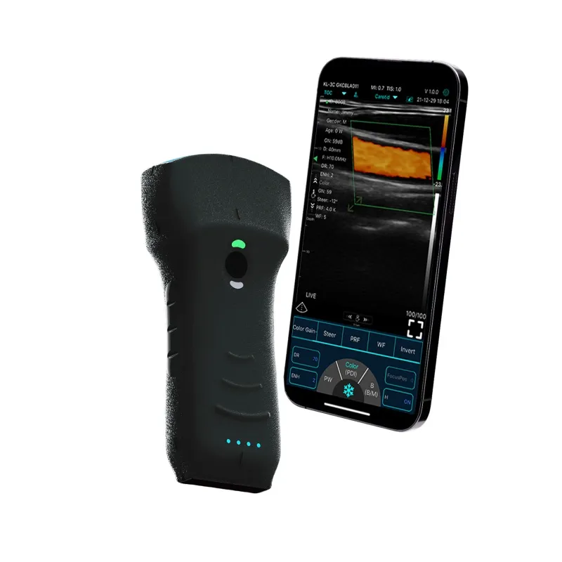 C10TXpro  Upgraded Wireless Ultrasound Scanner Dual-probes Multipurpose Ultrasound Convex +linear+ Cardiac Probe